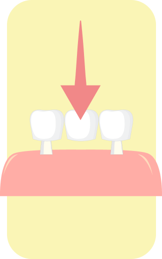 treatment image